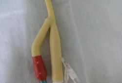 膀胱冲洗操作视频,步骤与技巧全解析